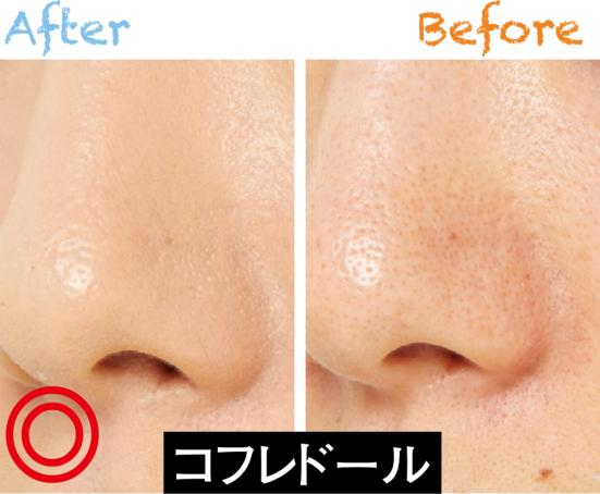 混合肌 凸凹毛穴悩み おすすめ保湿化粧下地ベストバイ 女性誌 Ldk The Beauty が徹底比較 年最新版 360life サンロクマル