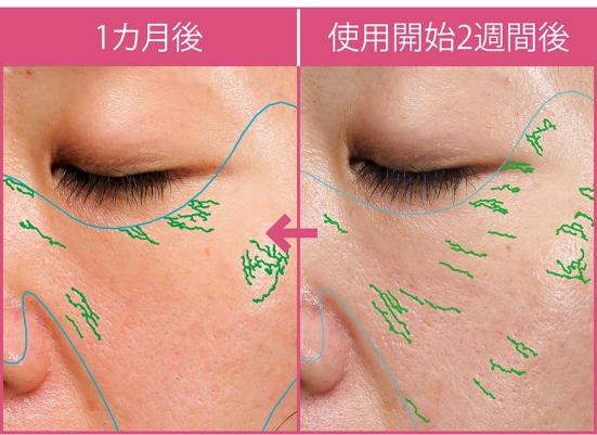 21最新 シワ改善美容液おすすめ人気ランキング10選 コスメ誌 Ldk The Beauty が徹底比較 360life サンロクマル