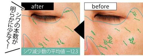 シワ改善美容液 ちりめんジワを撃退 リサージ 雜誌 Ldk が人気 定番コスメの実力を本音評価 360life サンロクマル